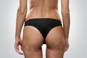 popo estetigi 300x200 1